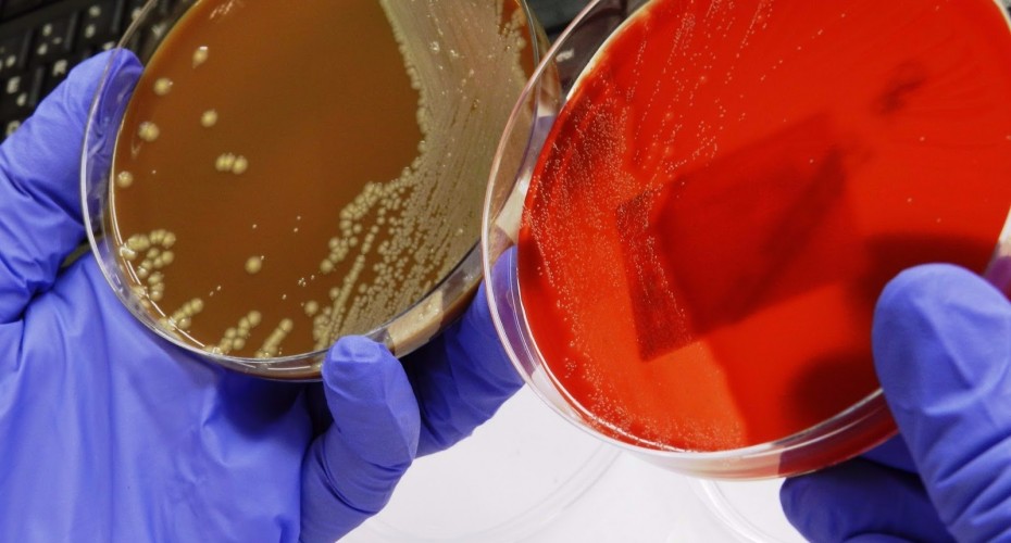 Lectura de cultius. Laboratori de Referència de Catalunya